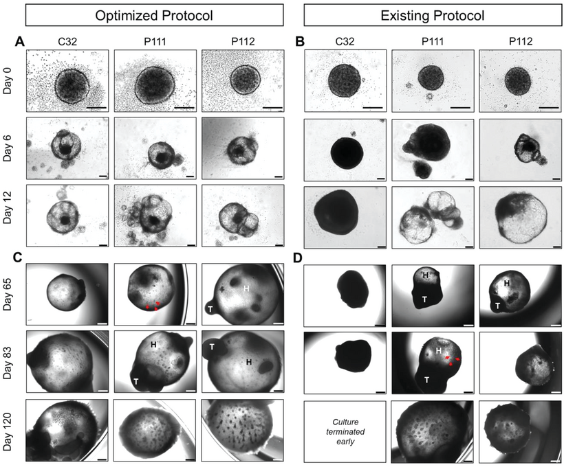 Fig. 2. Generation of human induced pluripotent stem cells (hiPSCs)-derived skin organoids (SKOs) from different cell lines.