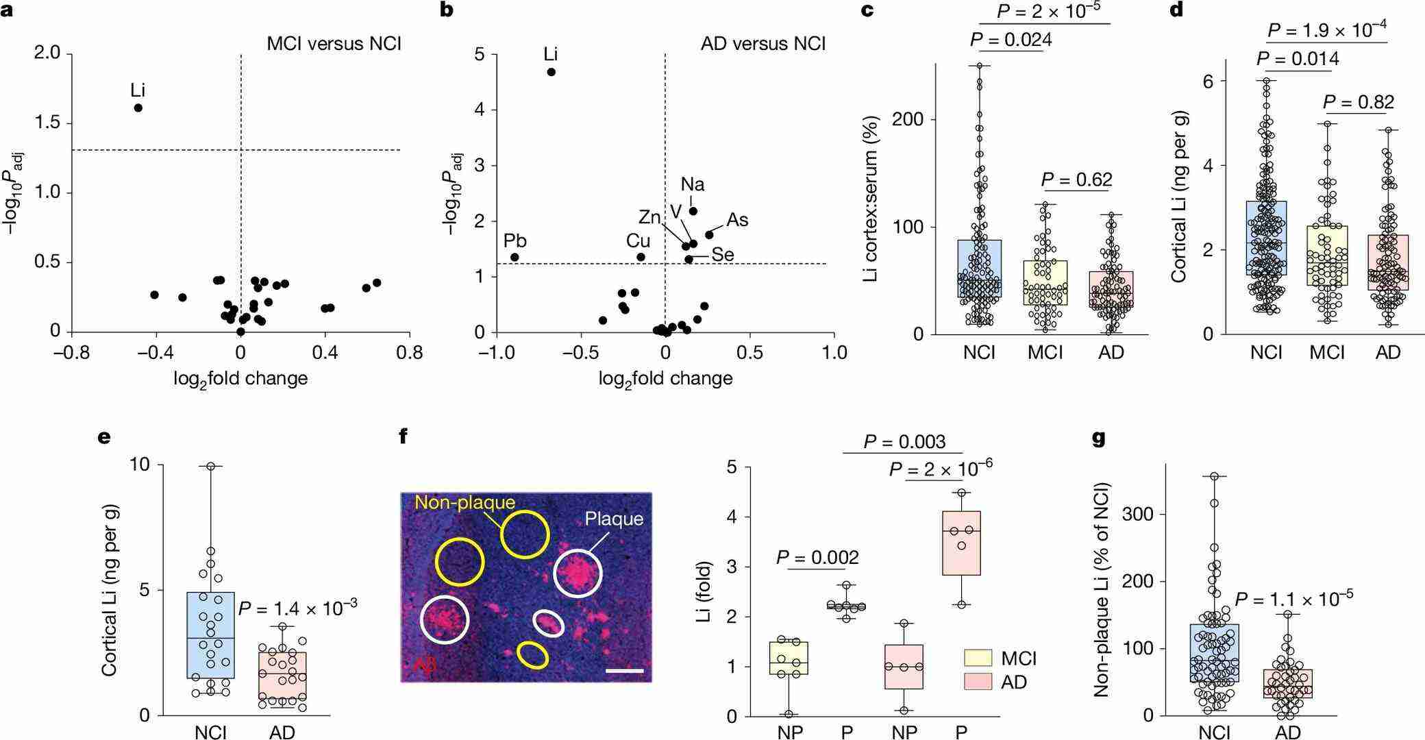 Lithium deficiency in mild cognitive impairment (MCI) and Alzheimer's disease (AD).