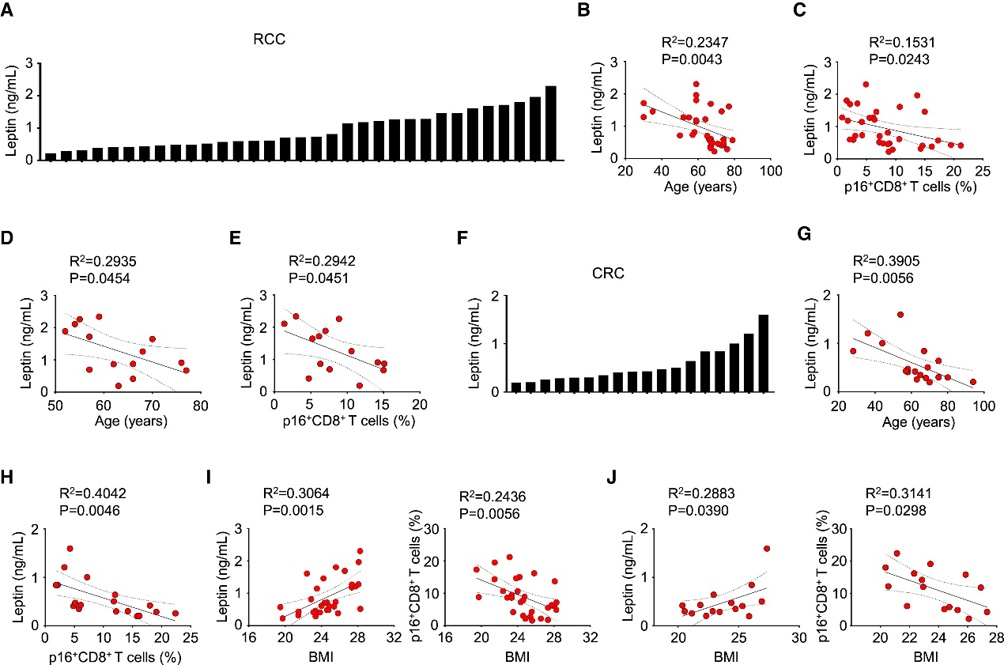 Age-associated decrease in leptin causes intratumoral CD8+ T cell senescence in patients with RCC, LC, and CRC.