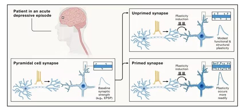 Antidepressants disrupt synaptic rigidity in depression and enhance brain plasticity through "synaptic priming".