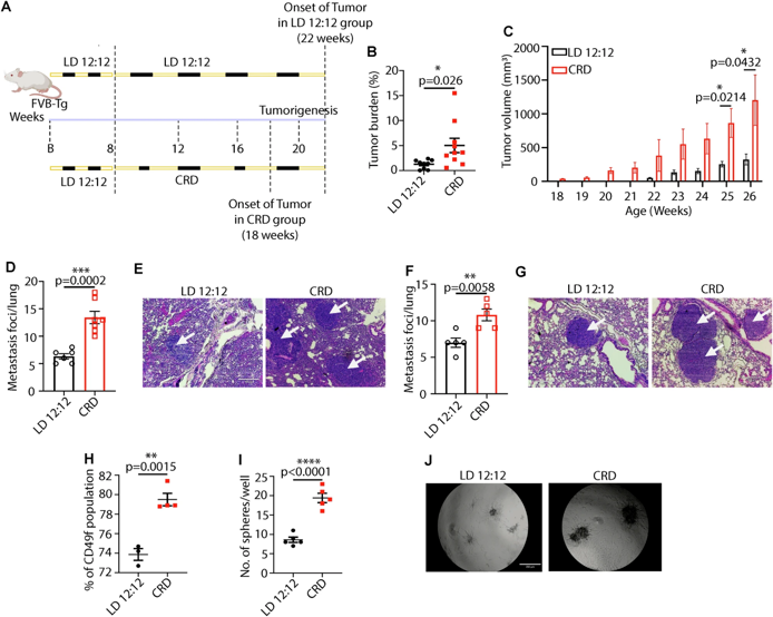 Chronic CRD accelerates aggressive mammary tumorigenesis and lung metastasis.