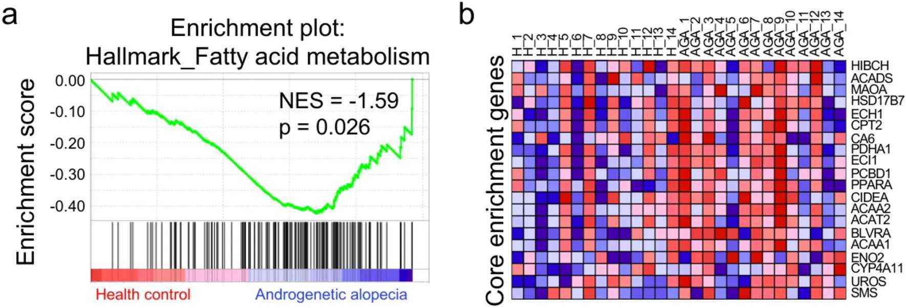 Downregulation of fatty acid metabolism in the scalp tissue of AGA patients