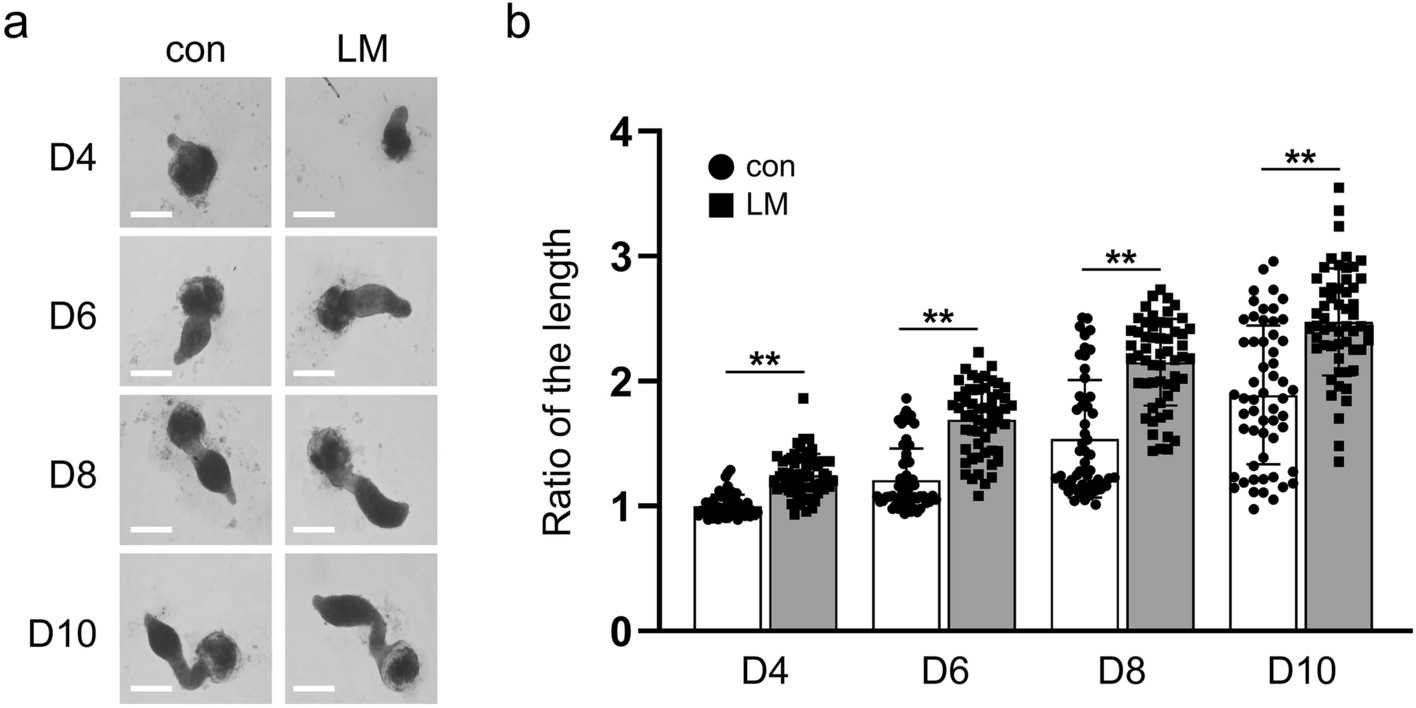 The sprouting of hair shaft-like structures in hair follicle organoids is reinforced by lipid treatment.